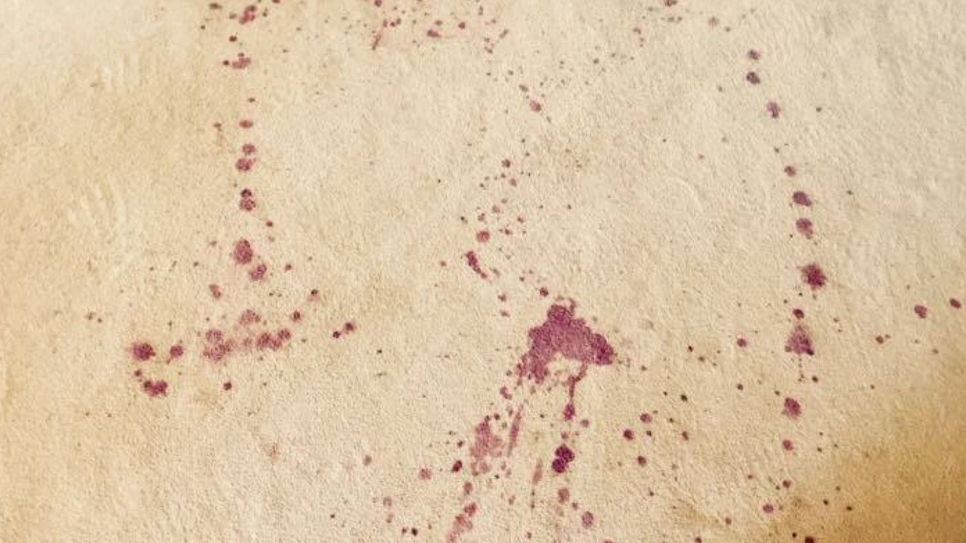 How to Get Blood Out of Carpet (Remove Stains Quickly)